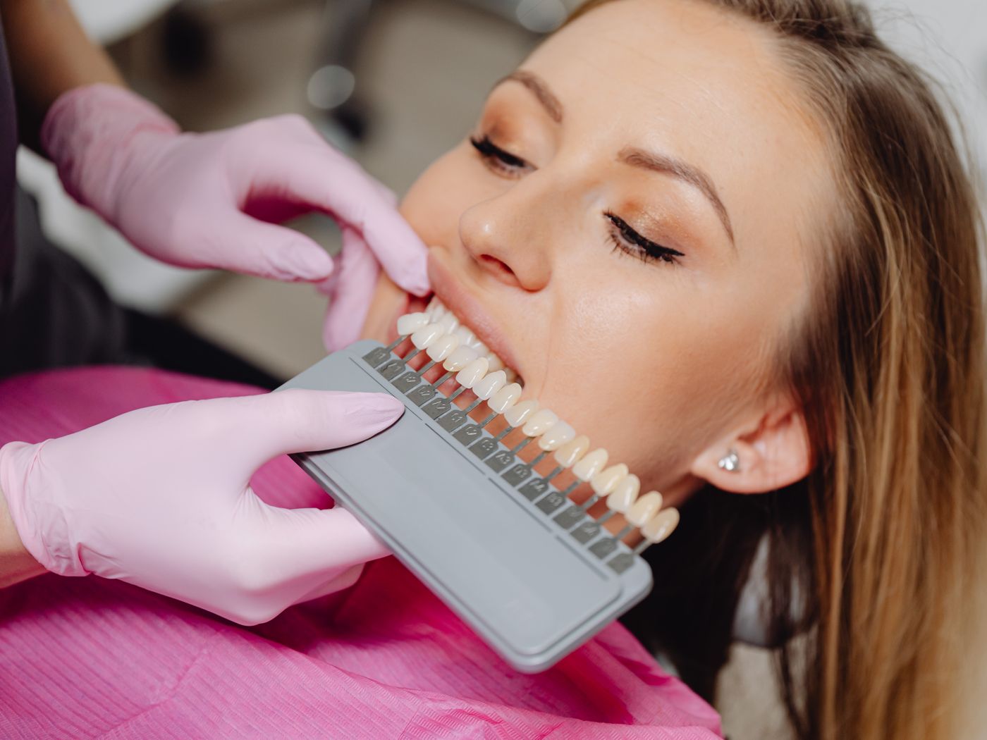 Close-up of a bright natural smile after cosmetic dental care