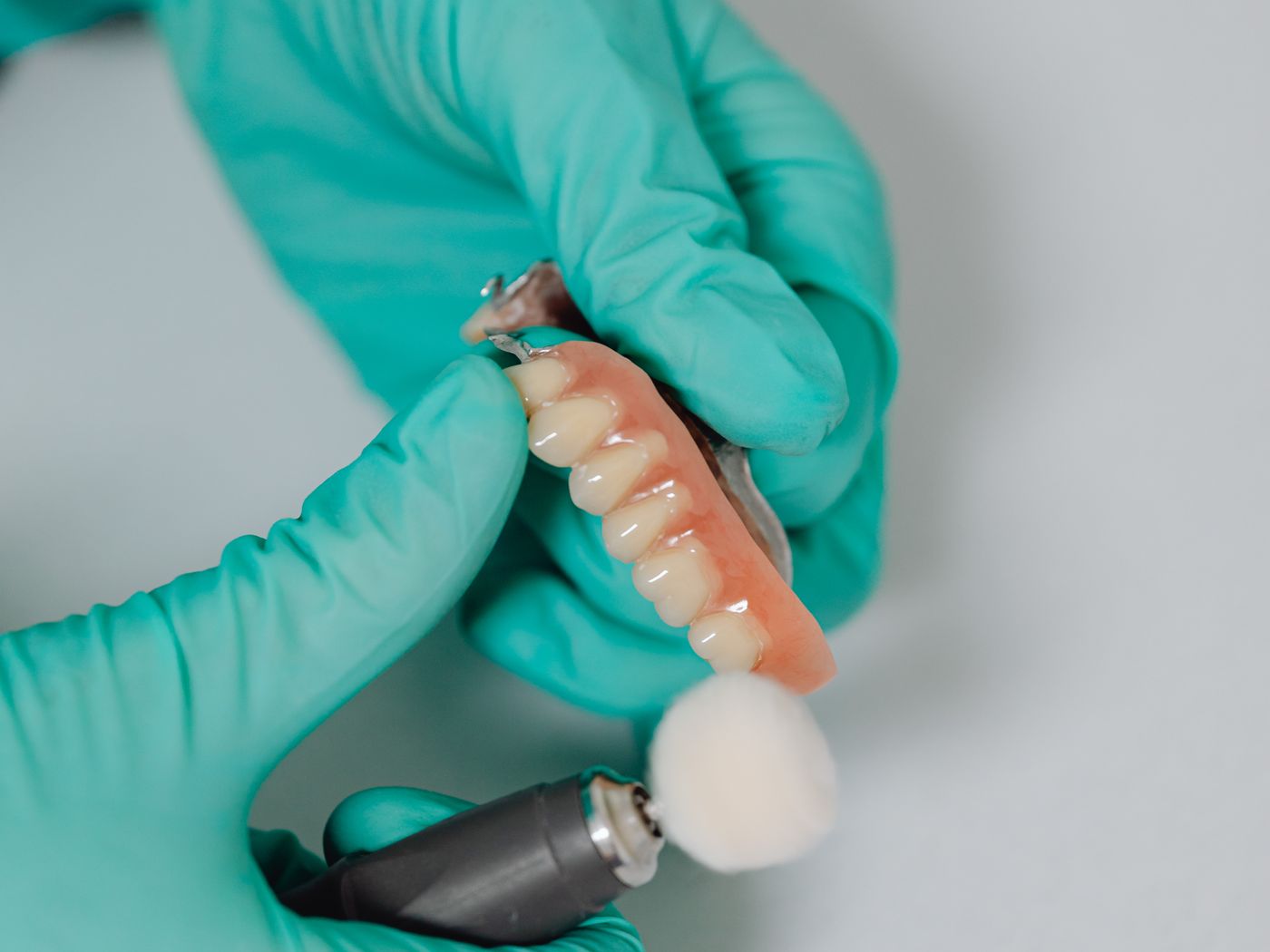 Dentures & Bridges at RC's Dentcare, Upper Bazar, Ooty