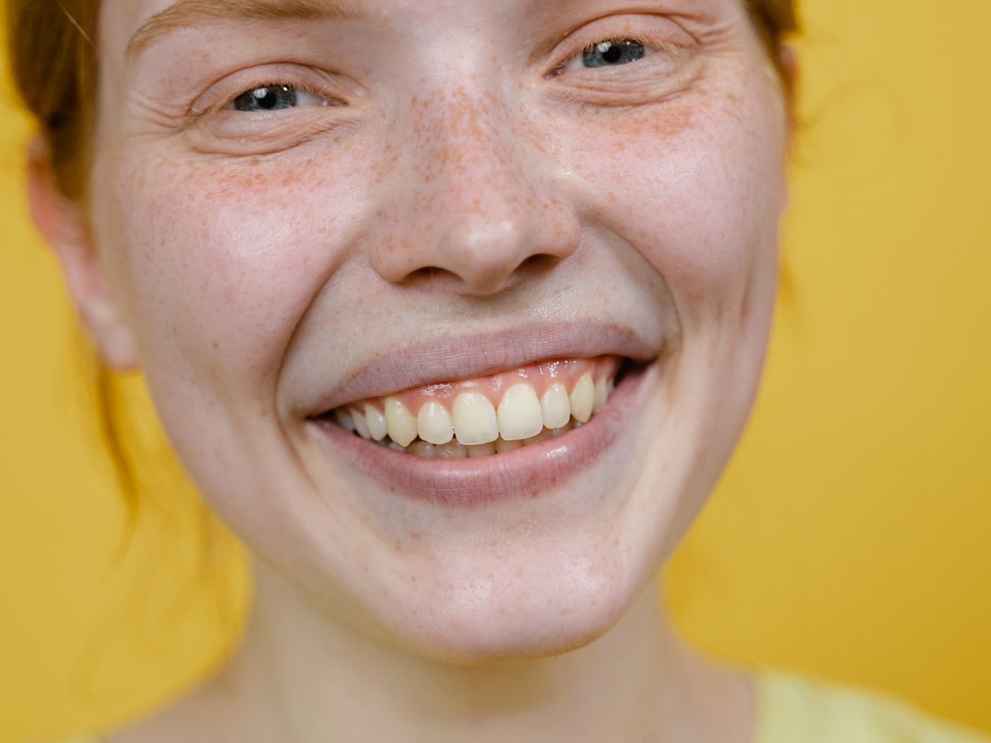 Fillings & Sealants at RC's Dentcare, Upper Bazar, Ooty