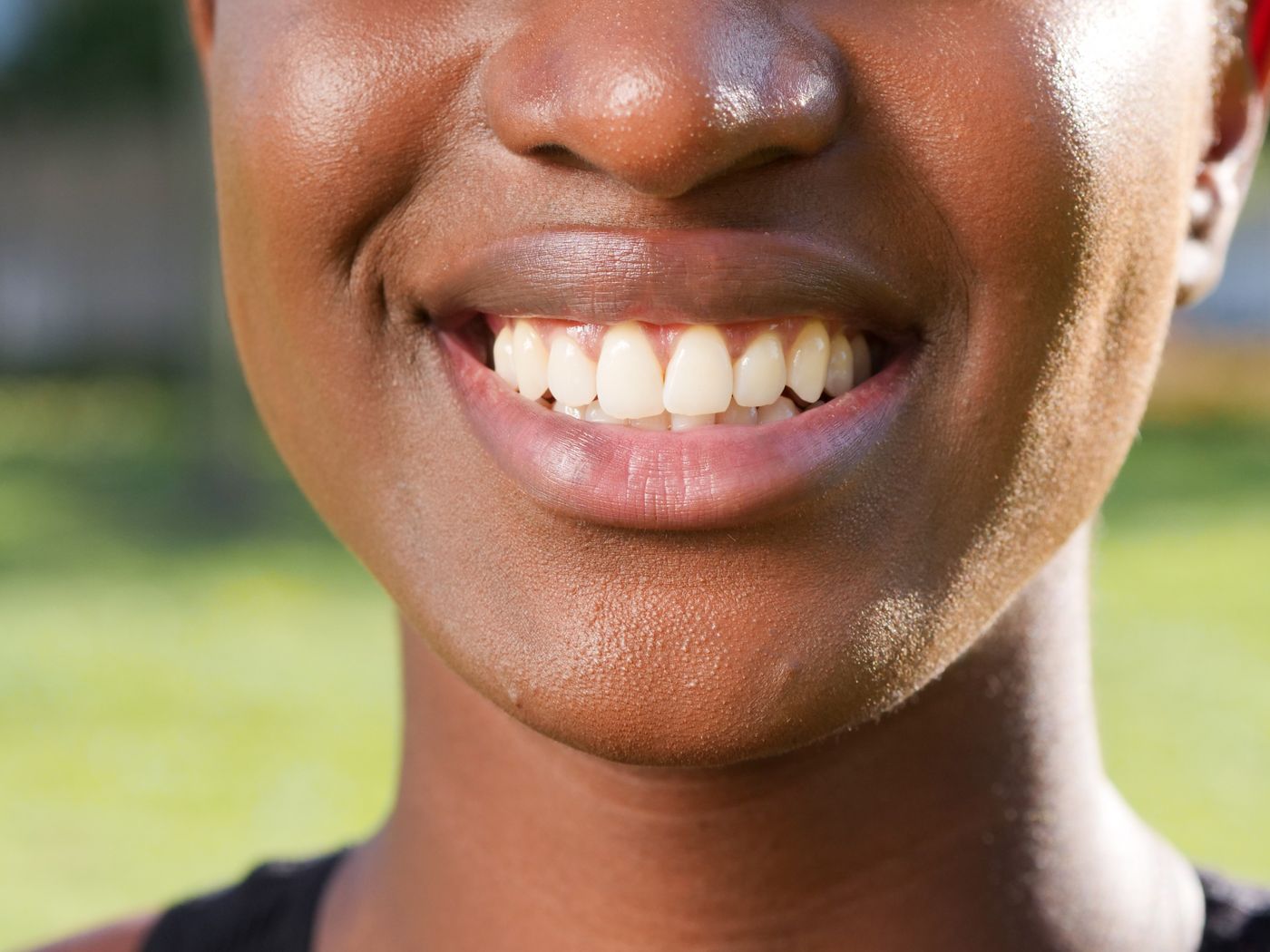 Mouth Guards at RC's Dentcare, Upper Bazar, Ooty