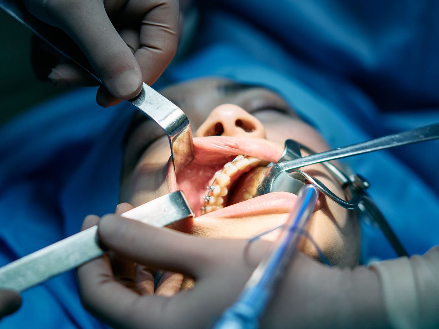 Modern dental operatory with treatment chair and overhead surgical light