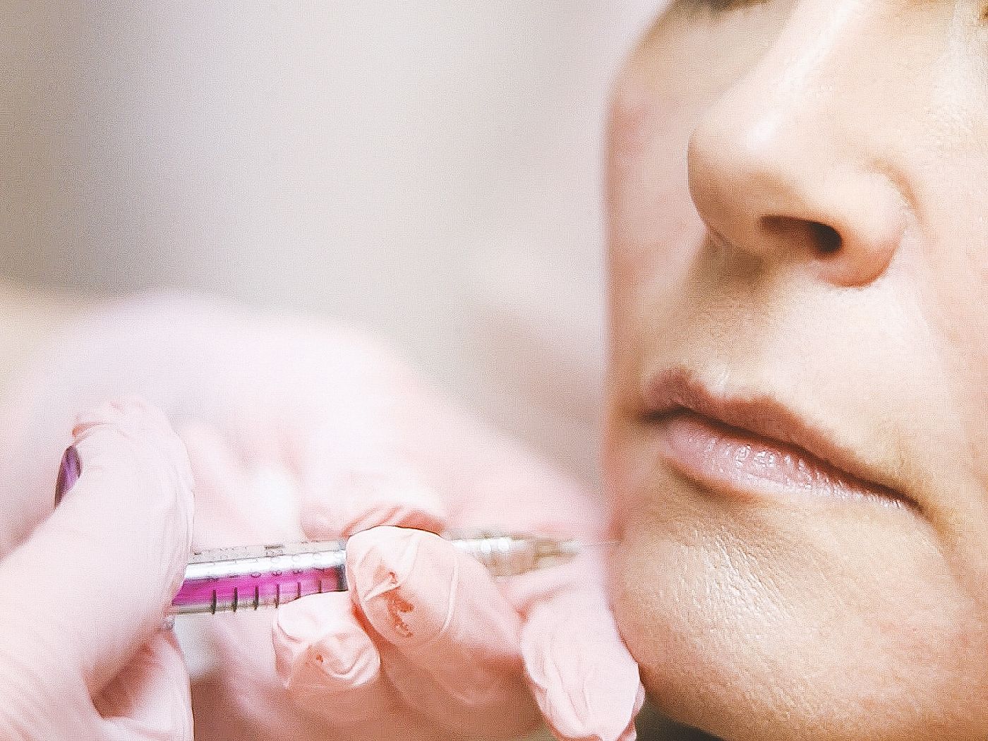 Root Canals at RC's Dentcare, Upper Bazar, Ooty
