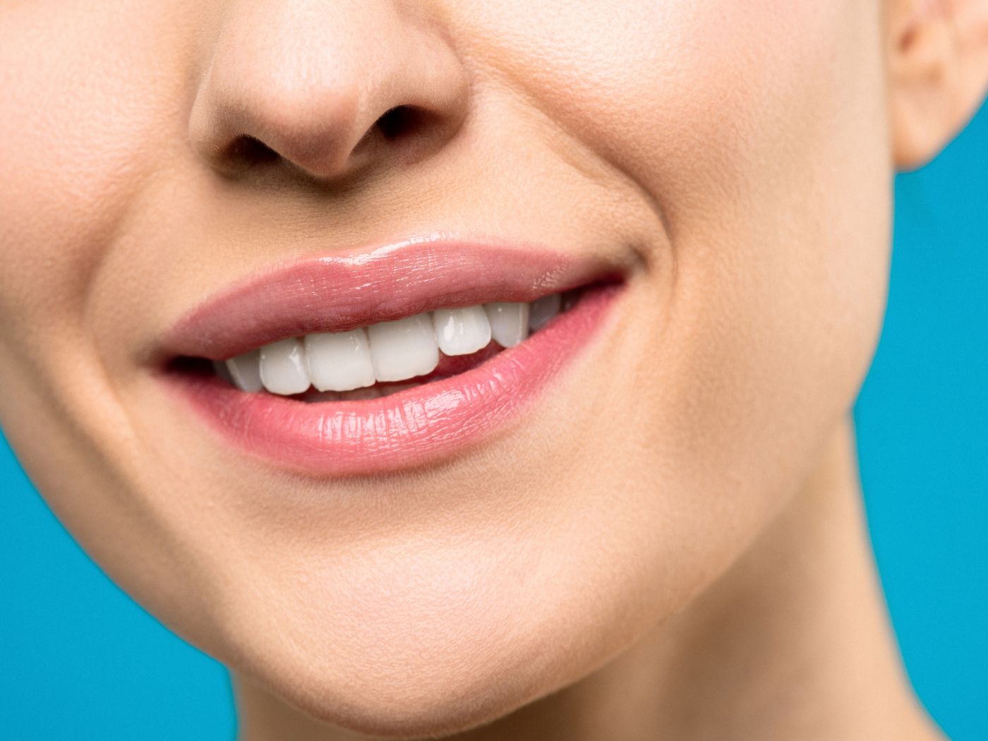 Teeth Whitening at RC's Dentcare, Upper Bazar, Ooty