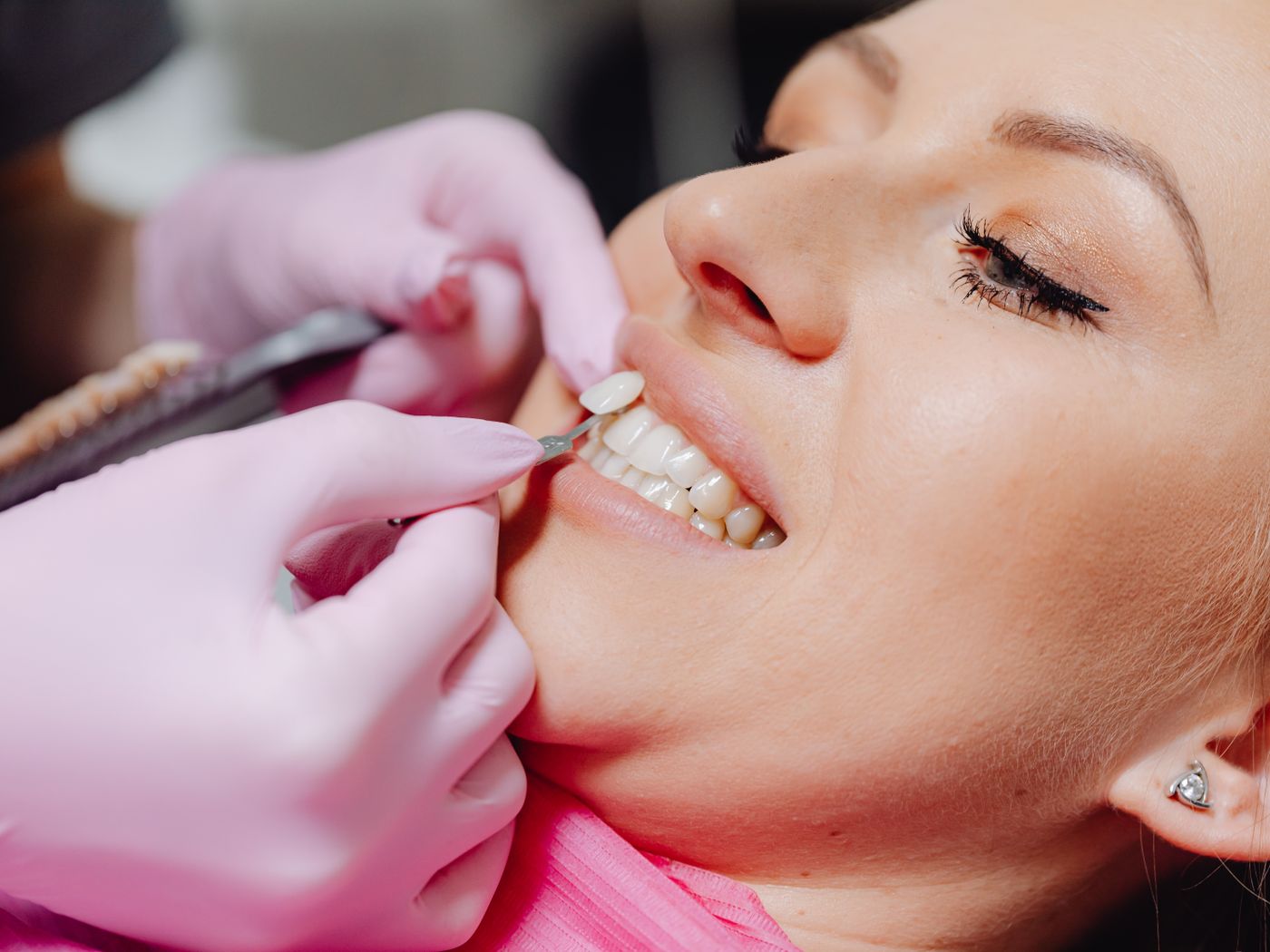 Ceramic crowns and veneers with a shade guide in a dental laboratory